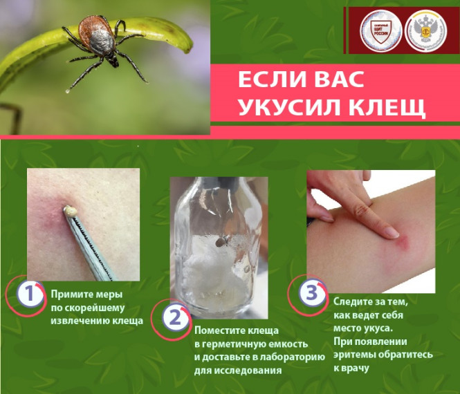 Памятка Осторожно! Клещи!. Памятка Осторожно! Клещи!.